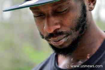 Black Man Shot in the Mouth by Mississippi Deputy to File Federal Civil Rights Lawsuit