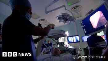 Royal Preston Hospital gets UK first lung cancer imager