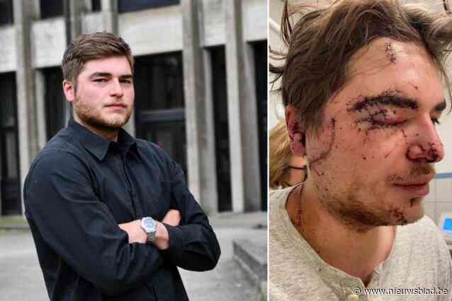 Dronkenlap die Sam (25) voor het leven verminkte met bierglas krijgt veertig maanden celstraf: “Telkens ik in de spiegel kijk word ik aan die vreselijke nacht herinnerd”