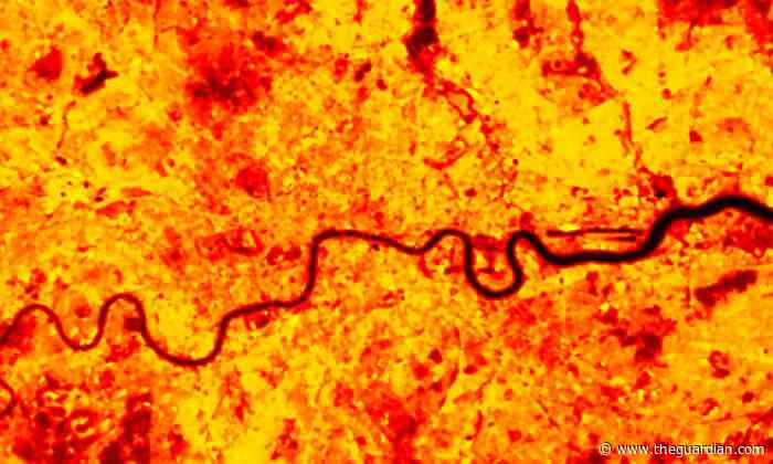 Sewage from space and urban heat islands: how location data can help tackle ecological crises