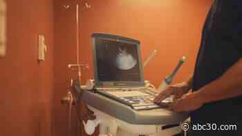 Proposed CA bill could provide coverage for fertility care