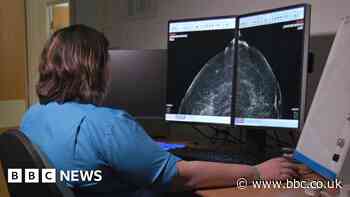Aberdeen AI trial helps doctors spot breast cancers