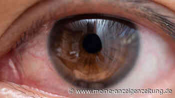 Hitze und seine Folgen: Augen zeigen erste Anzeichen einer Dehydration
