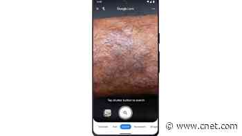 Google Lens Now Lets You Search for a Skin Condition. Here's How     - CNET