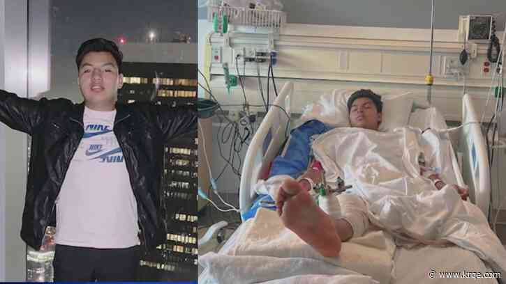 Teen loses leg after suspected drunk driver crashes into him at California bus stop