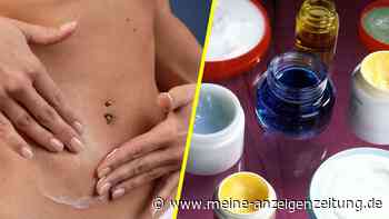 Was ist besser nach dem Sonnenbrand – After Sun oder Bodylotion?