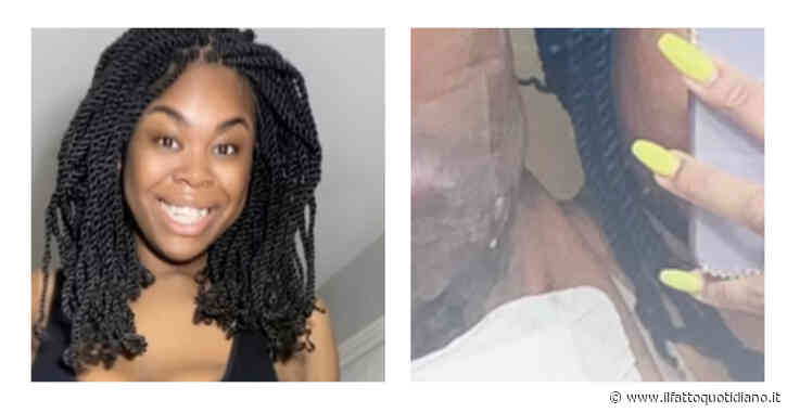 “Ho dovuto smettere di depilarmi a causa della malattia di Verneuil: meglio i peli che cisti grandi come palline da tennis”: la storia di Imani e il parere della dermatologa