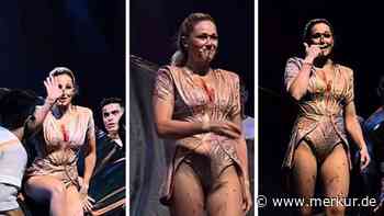 Unfall bei Liveshow: Blutüberströmte Helene Fischer muss Konzert abbrechen