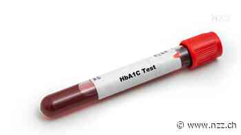 Verborgenes Risiko – was sich aus der langfristigen Zuckerbelastung im Blut herauslesen lässt