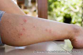 All UK tourists warned of deadly dengue fever found abroad