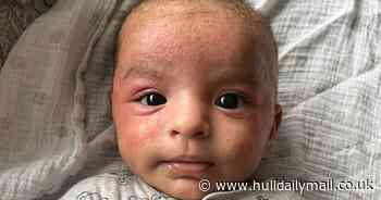 Mum says waving goodbye to UK to travel world cured baby's chronic eczema