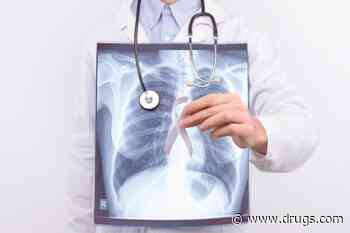 2019 to 2021 Saw Rise in Lung Cancer Screenings