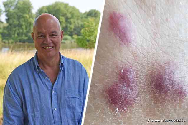 Guy (58) heeft zoveel last van knijtenplaag dat hij naar rechter stapt: “Honderden gezinnen hebben er last van”