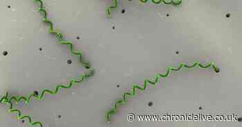 Medieval disease syphilis is on the rise in North East - this is where the infections are