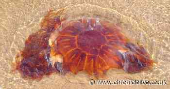 Jellyfish beach warning as mum suffers 'worst pain of life' after being stung