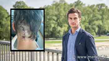 Fast verblutet, als er helfen wollte: Münchner auf Reichenbachbrücke von hinten attackiert - Haft für Täter?