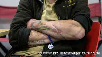 Tranq - die Droge, die das Fleisch zerfrisst