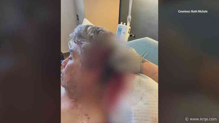 Tucumcari man attacked by dog in front yard