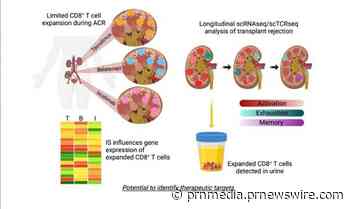 Research Reveals Novel Insights into Transplant Rejection and New Drug Development Targets