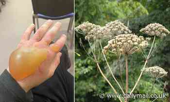 Would YOU recognise Britain's most dangerous plant? How to spot giant hogweed - and how to rid of it