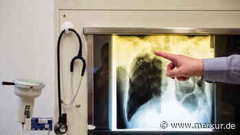 Tuberkulose-Fall im Landkreis: Betroffener isoliert und in Behandlung