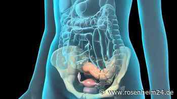 Eierstockkrebs erkennen: Neuer Test soll Diagnose erleichtern