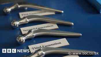 NHS at 75: The professor who made artificial hips in his shed