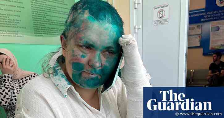 Attackers break Russian journalist’s fingers and stab human rights lawyer in Chechnya