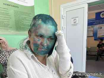 "Smetti di scrivere". Giornalista russa colpita con la vernice tossica