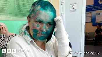 Chechnya Milashina attack: Armed thugs beat up Russian journalist and lawyer