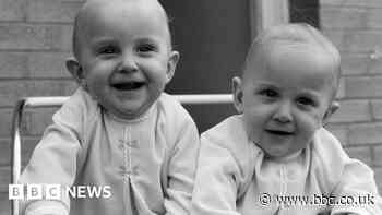 UK's first separated conjoined twins forever grateful to NHS