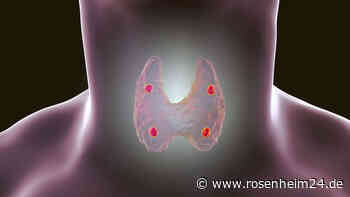 Sechs Symptome einer Überfunktion der Nebenschilddrüsen