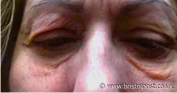 Mum-of-three who feared she was losing sight when eyes ‘glued shut’ finds miracle cure