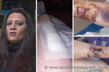 Owner of danger dog which mauled Blackburn woman spared jail