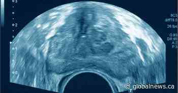 Higher risk of aggressive prostate cancer in Indigenous men, study shows