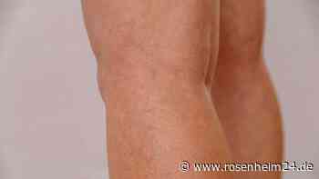 Thrombose erkennen: Sechs Warnzeichen, die vom Bein ausgehen