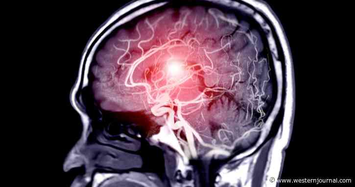 Mysterious Cause of OCD May Have Just Been Revealed: Study