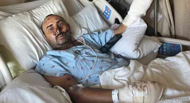 Gardener loses hand after discarded firework explodes in California neighborhood