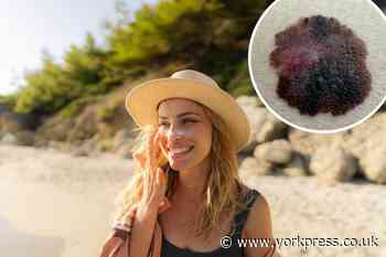 What is melanoma cancer? Symptoms and when to see a doctor