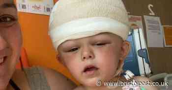 Beau's skull is broken apart and put back together to stop his brain being crushed