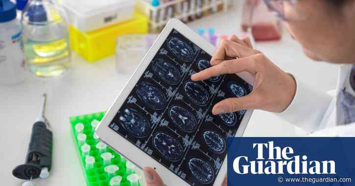 Alzheimer’s most prevalent in US east and south-east, first-of-its-kind study finds