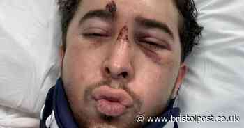 'I was paralysed from neck down but recovered to kick friend in crotch'