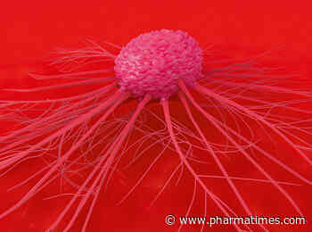 CatalYm highlights GDF-15 as main anti-PD-1 resistance factor