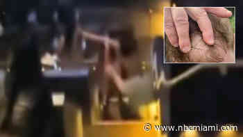 ‘Went to town on me': Victim of brutal Pompano Beach movie theater beating speaks