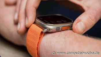 Apple Watch: Code vergessen - das ist zu tun