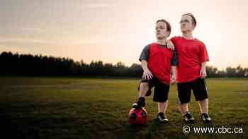 Edmonton twins to represent Alberta at World Dwarf Games