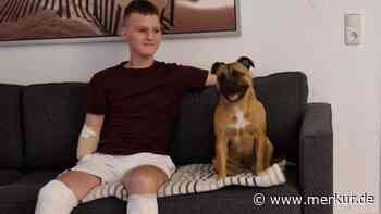 Ärzte wurden „ganz panisch“: 14-Jähriger erkältet sich – dann verliert er Arme und Beine