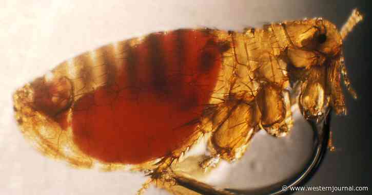 Man Loses Hands and More After Series of Amputations Following Flea Bite
