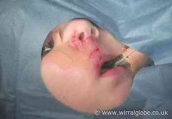 Merseyside Police launch campaign to reduce dog bite incidents