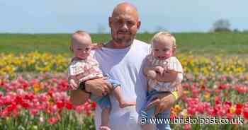 'People can't believe' girl is three times the size of her twin